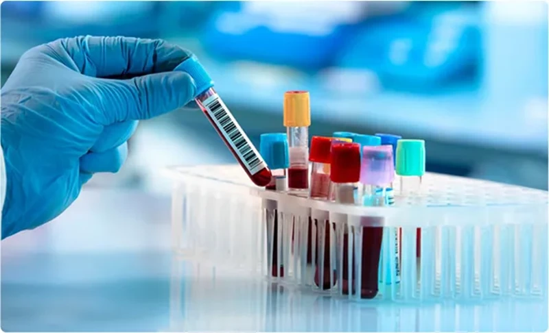 Các xét nghiệm sinh hóa