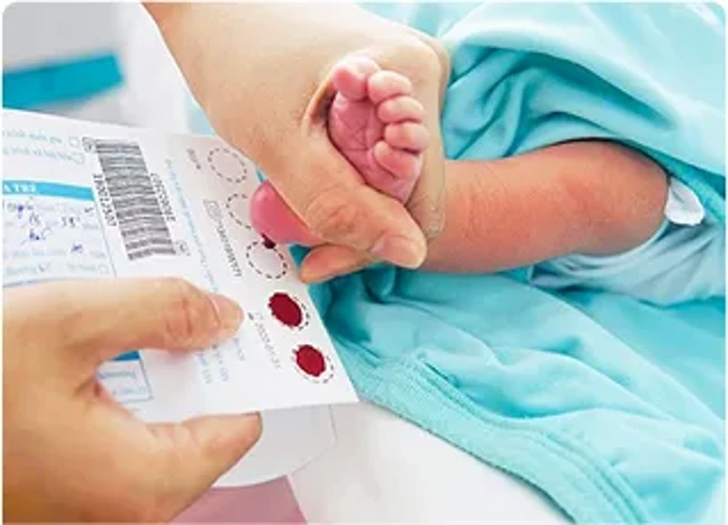 Gói sàng lọc sơ sinh