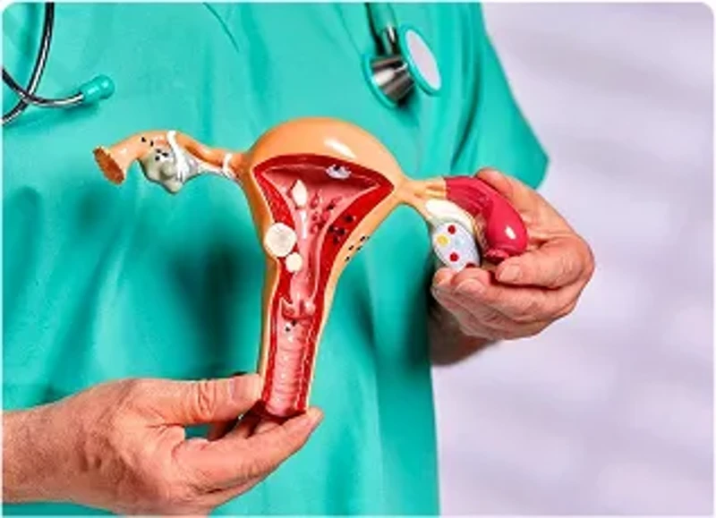 Xét nghiệm tế bào cổ tử cung